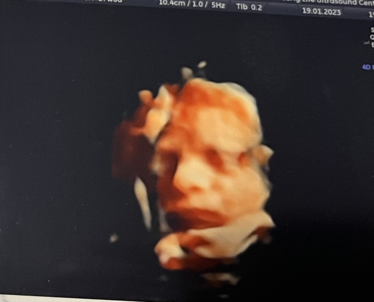 4D scan