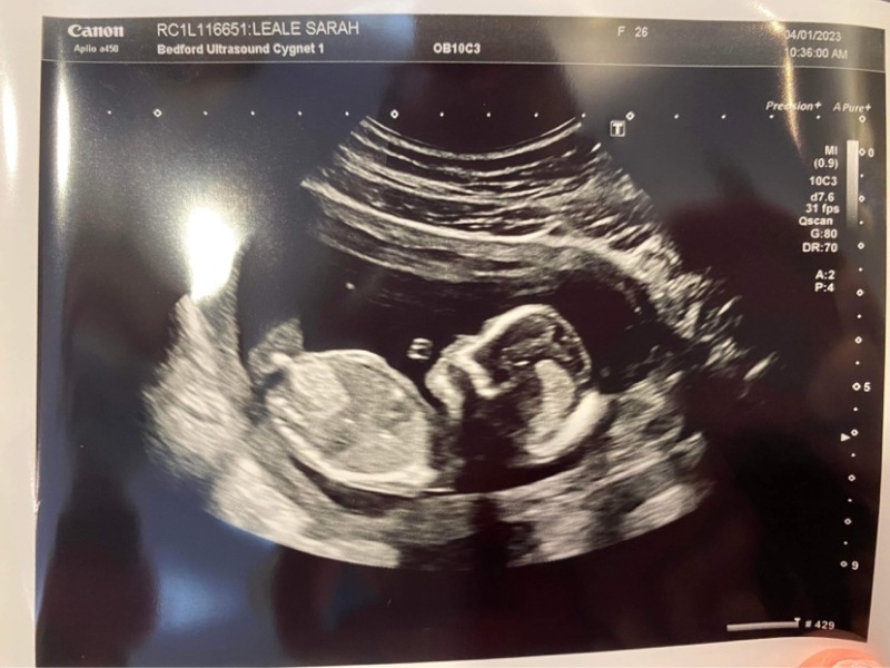 Boy or girl?