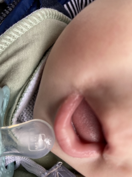 Teething - can feel sharp teeth rather than gums