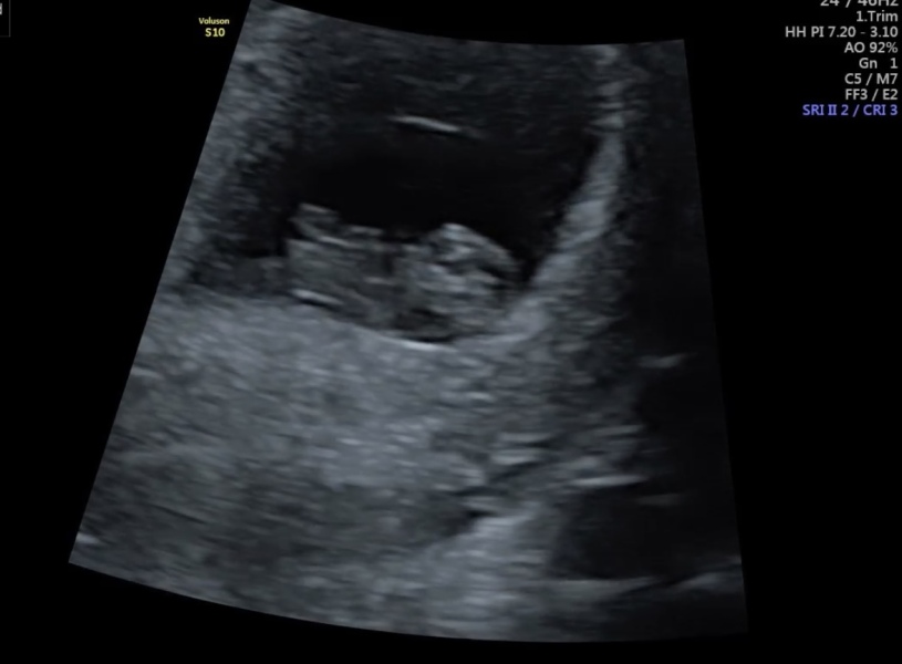 August Due Date Crew (Thread 5)