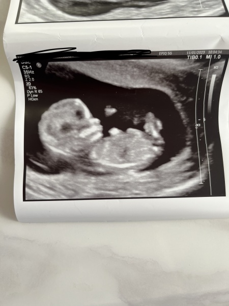 ABC IVF timeline & advice