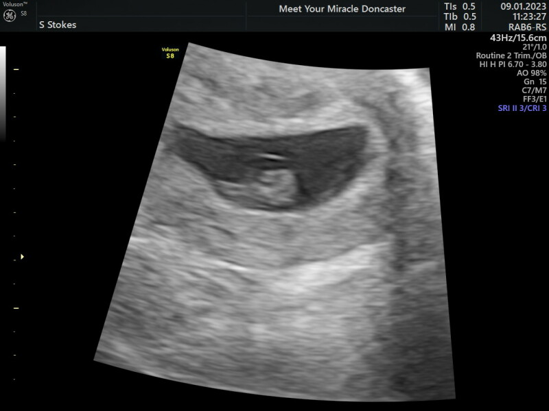 Due end of Aug/Sept babies 🤞🏻