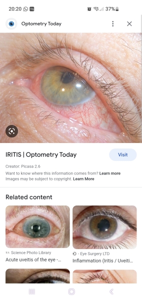 DD15 has an eye.. thing? Advice and ideas please! 
