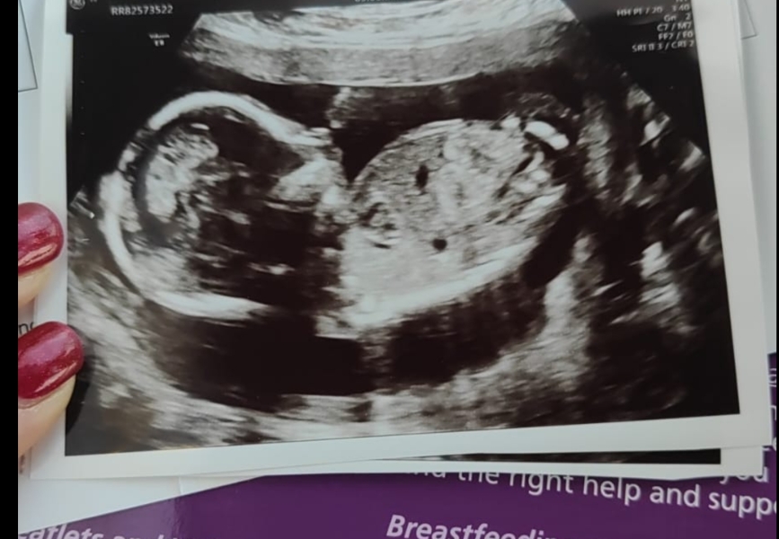 July 2023 (Thread 2)! 