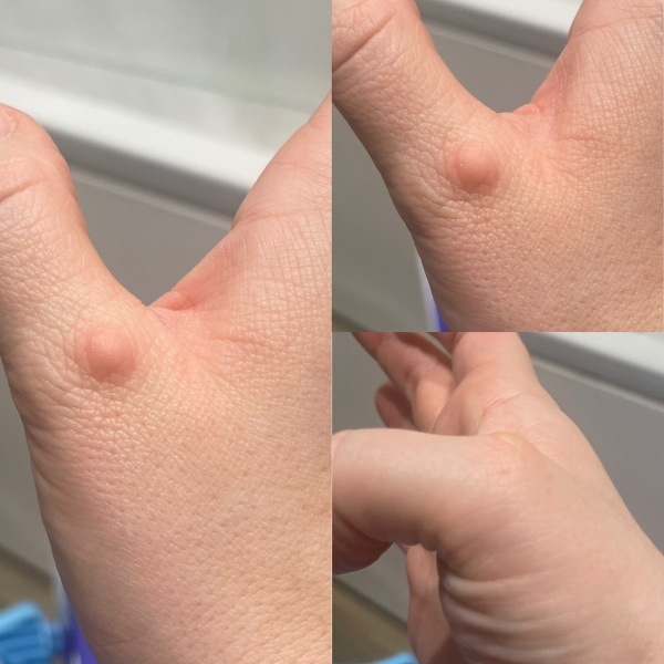 What is this on my thumb?