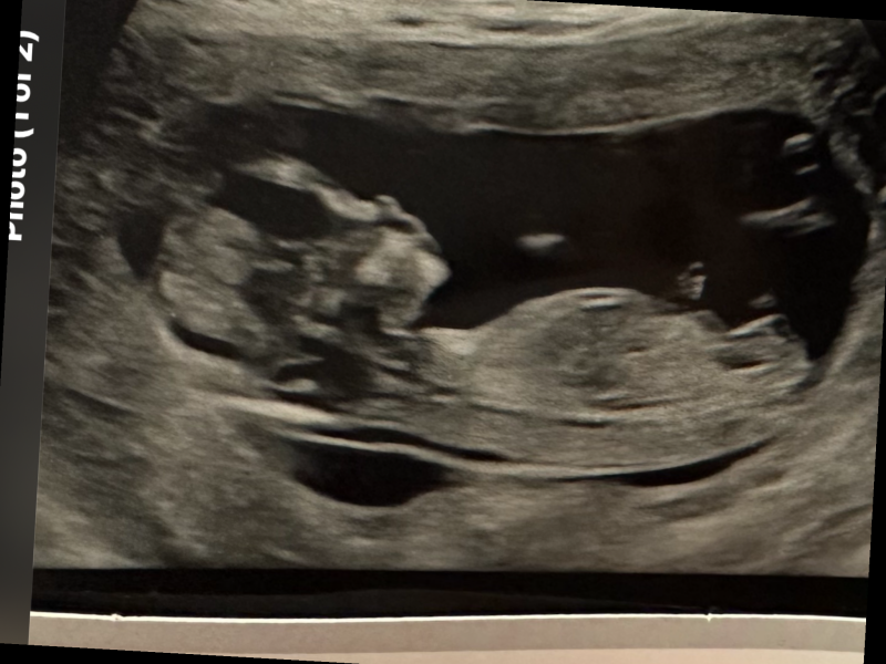 Gender guesses because I'm impatient!