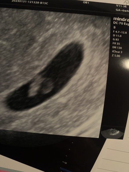 5 weeks today! Sep 23 Thread