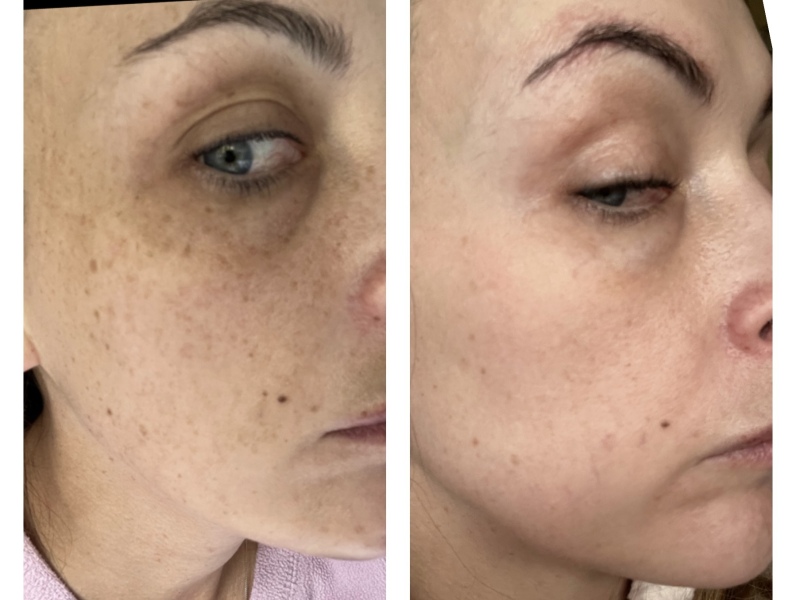 Please help me improve skincare routine!