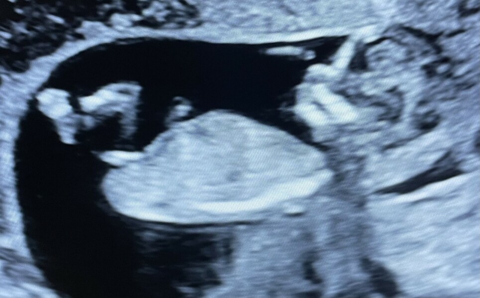 Gender Nub theory, guesses please! 12+5