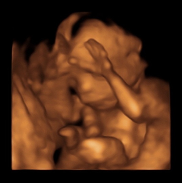 June 2023 Babies ☀️ (Thread 3) 