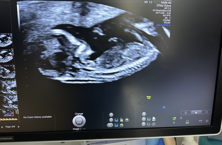 August Due Date Crew - Into Trimester 2 (Thread 6)