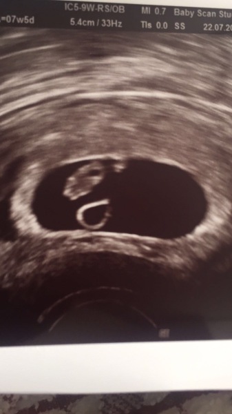 Just found I am pregnant