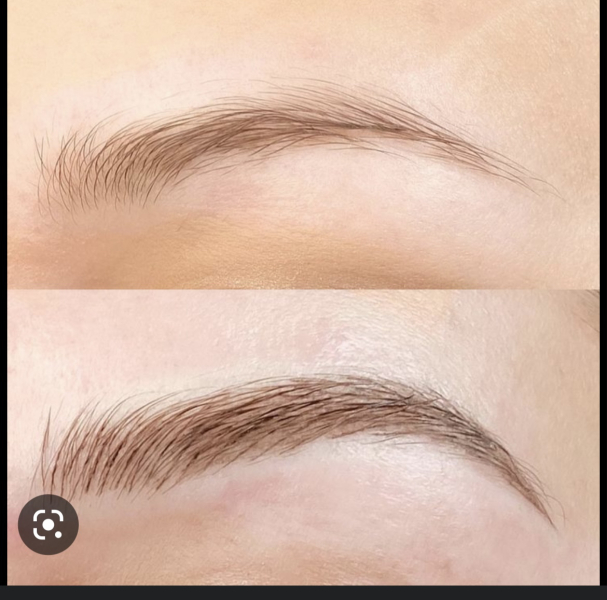 Cosmetic surgery DOES affect others