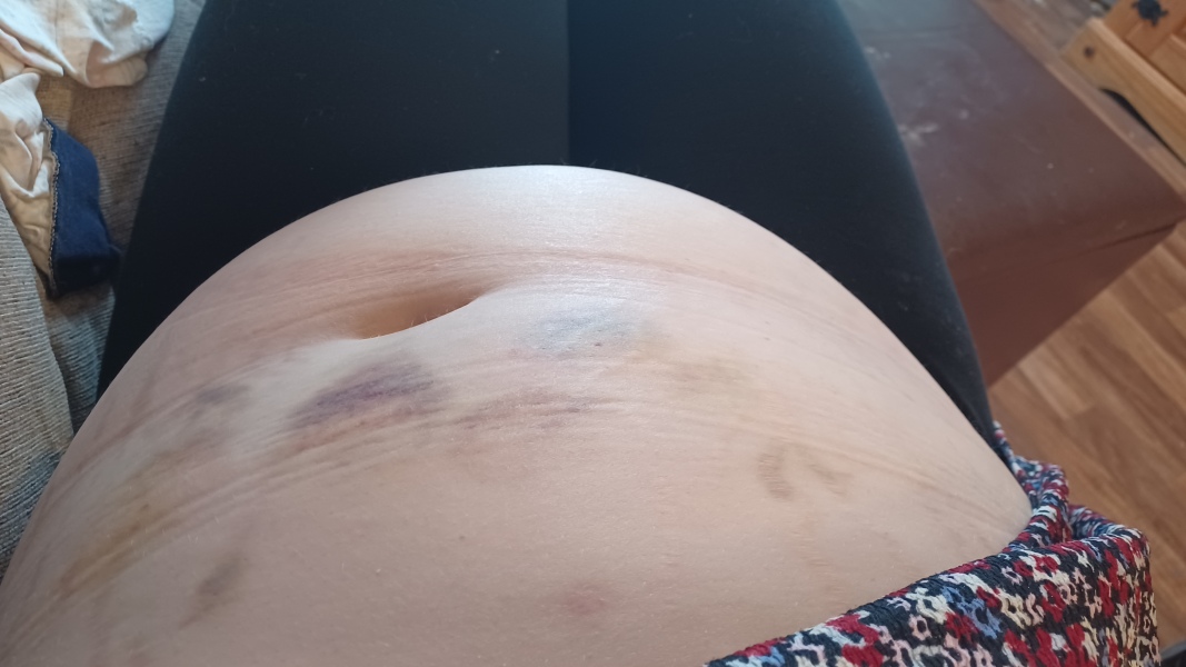 Due March 2023 - Thread 7