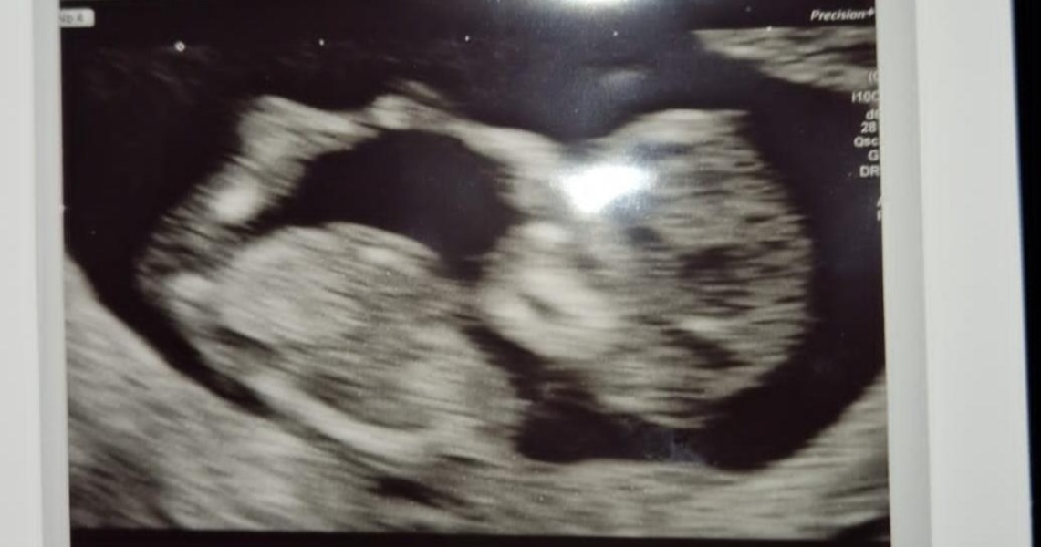 Boy or girl