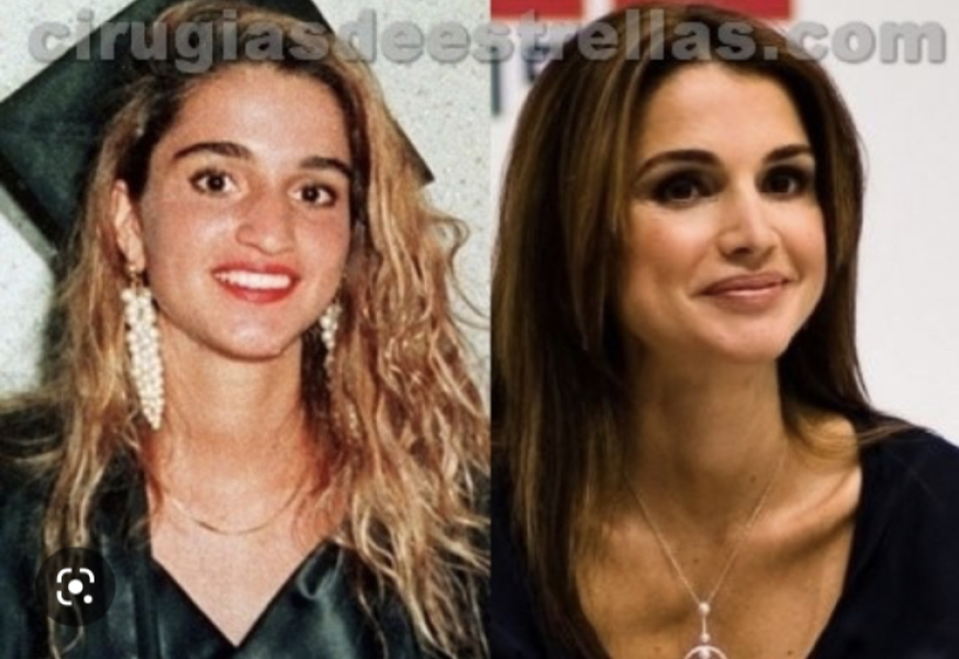 Who's the most attractive Royal in your opinion?