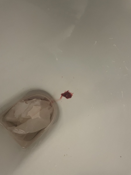 TW possible miscarriage