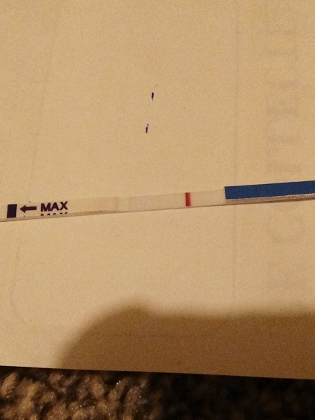 I have had trigger shot yesterday for first time 