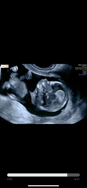 August Due Date Crew - Into Trimester 2 (Thread 6)
