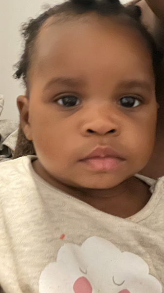 Please be kind. Small Eyes?