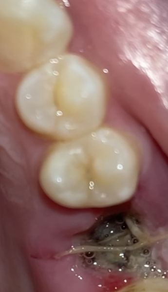 Is this normal? TMI pic attached - any dentists around?!