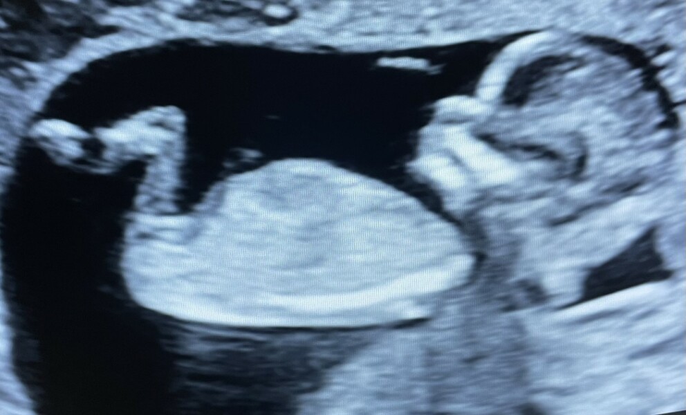 Gender Nub theory, guesses please! 12+5