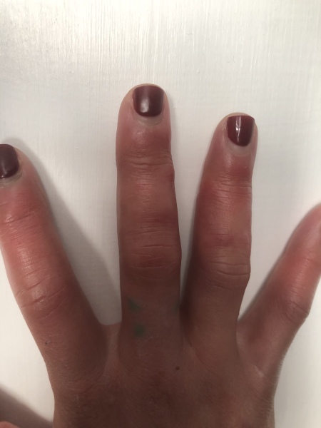 Help diagnose my hands (photo)