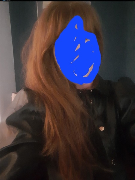 Why the fuck are some English people so nasty about ginger hair?