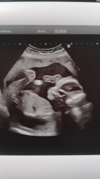 June 2023 Babies ☀️ (thread four)