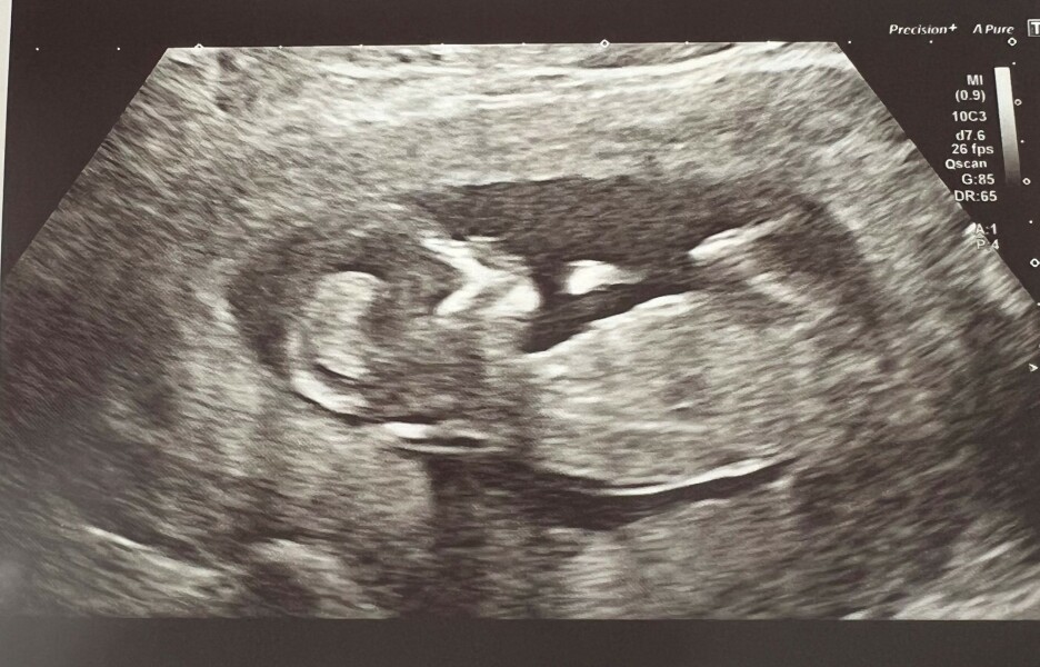 July 2023 (Thread 2)! 