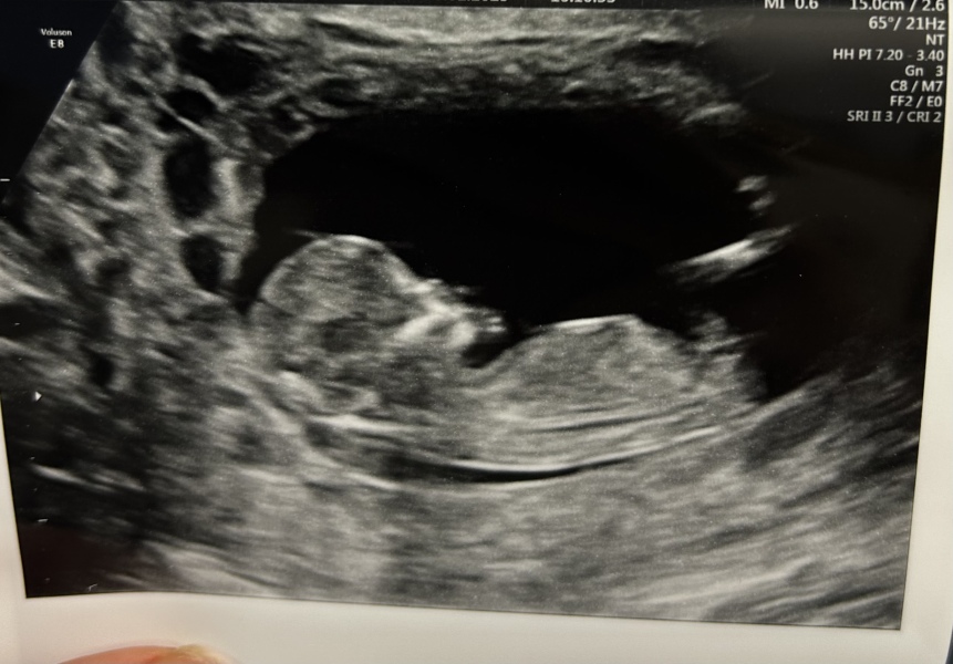 August Due Date Crew - Into Trimester 2 (Thread 6)