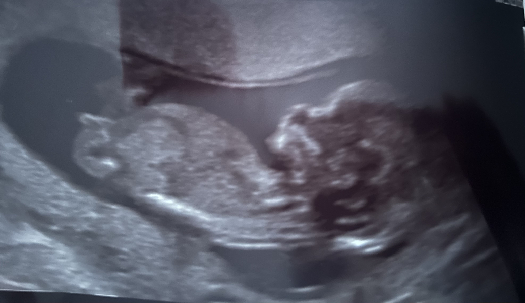 August Due Date Crew - Into Trimester 2 (Thread 6)
