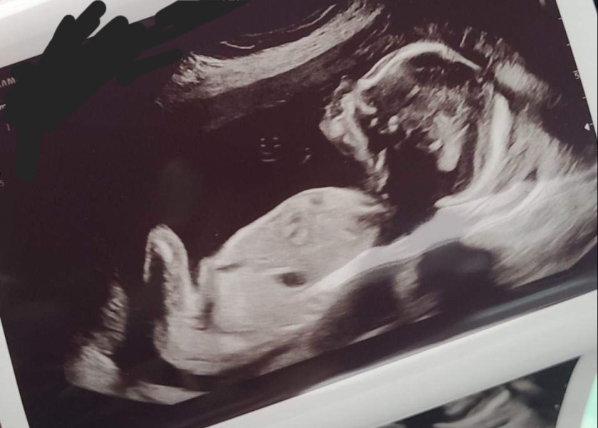 Boy or girl :D