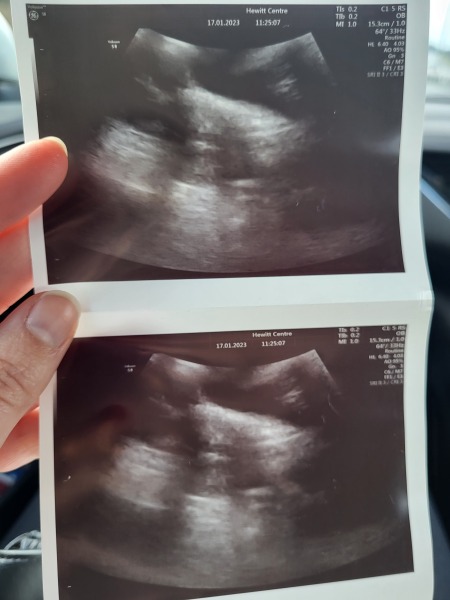 Starting IVF December 2022- looking for a tribe!