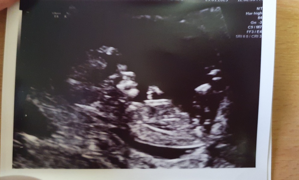 August Due Date Crew (Thread 5)