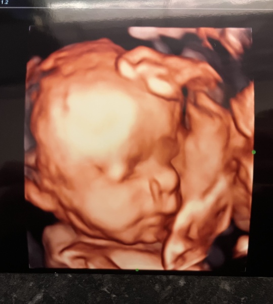 4D scan