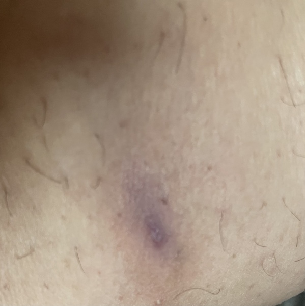 God help me! It’s a crater 