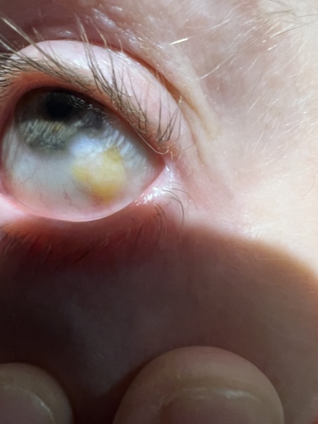DD15 has an eye.. thing? Advice and ideas please! 