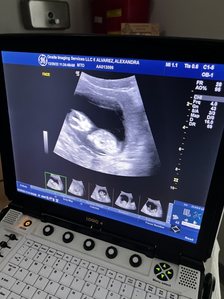 Gender guesses 😊