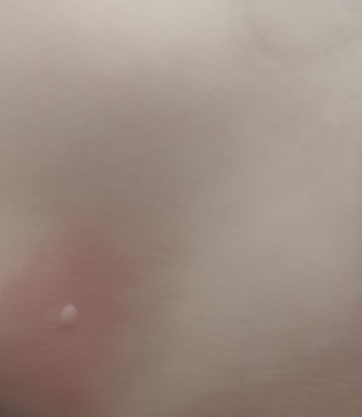What could this spot be? (Pic included)
