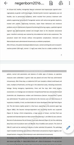 Complications from  trans surgery!