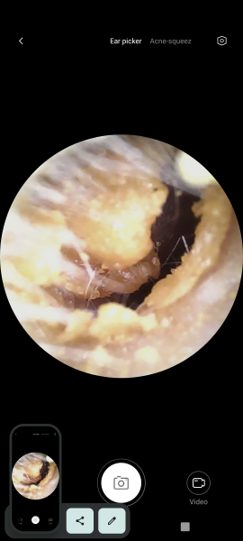 Me with my ear camera again 