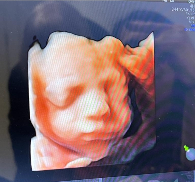 Due March 2023 - Thread 6