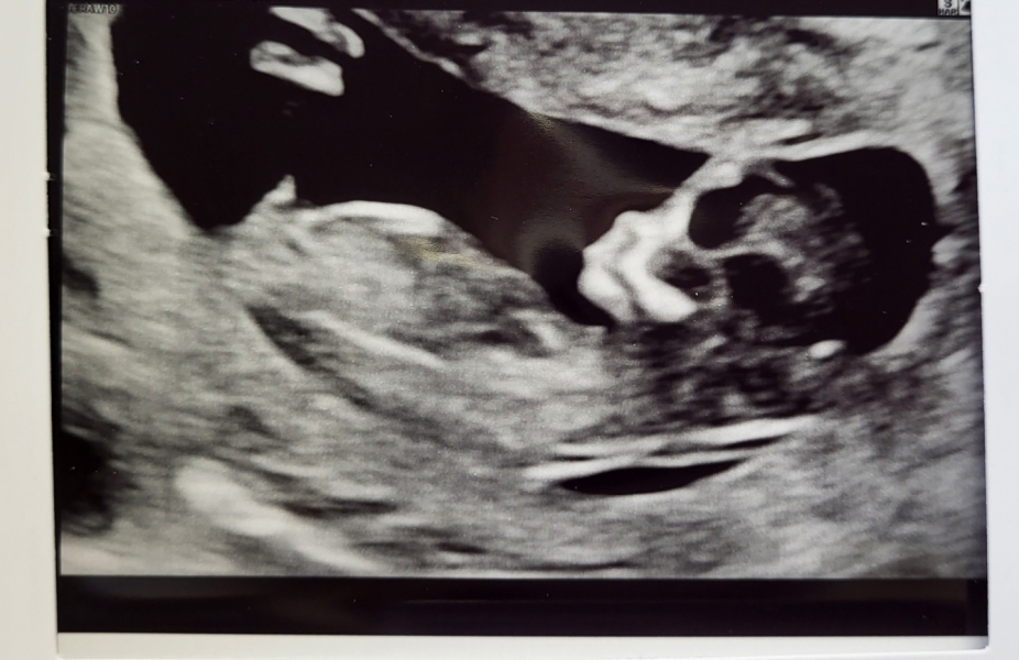 Due July 2023