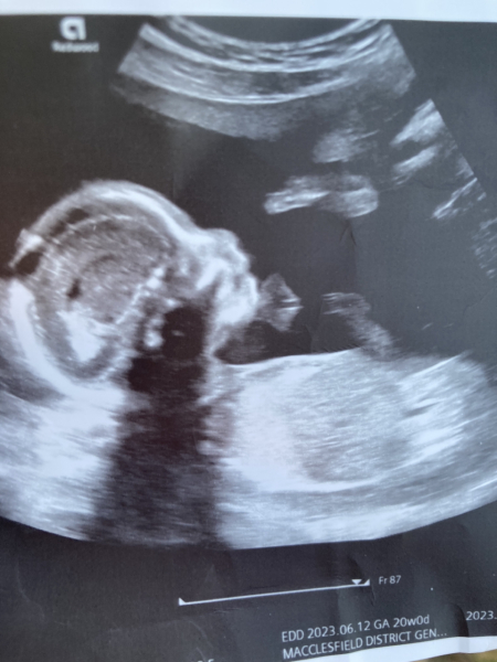 Find out the sex today, bit excited
