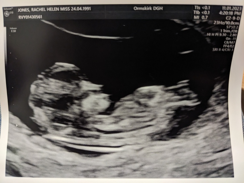 July 2023 (Thread 2)! 