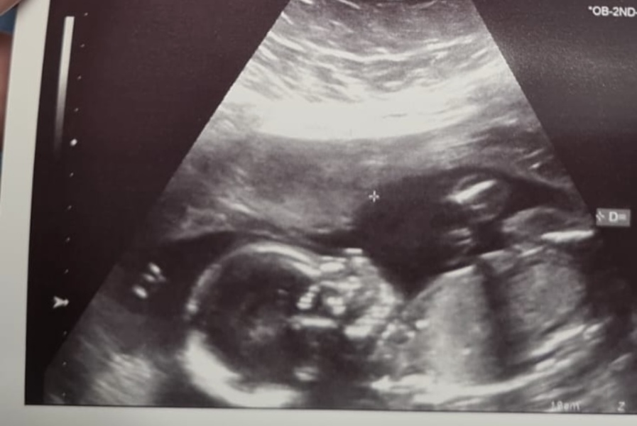 June 2023 Babies ☀️ (thread four)