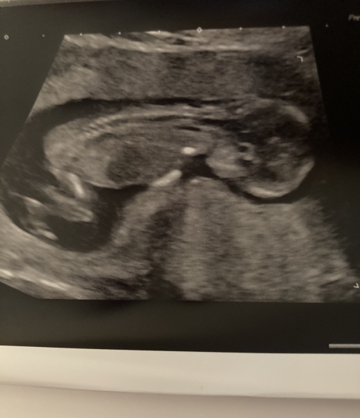 Due July 2023
