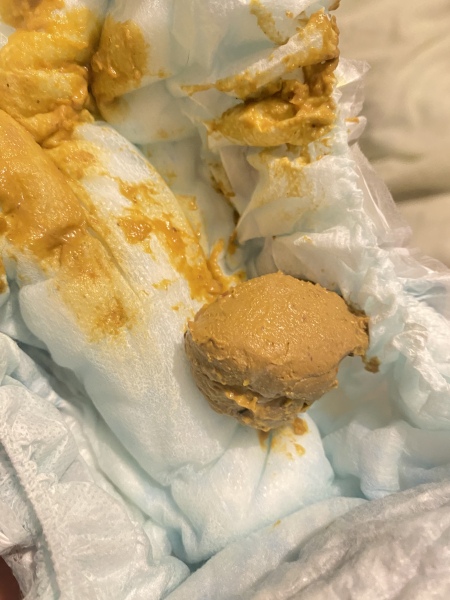 Pale poo? -Pics included-