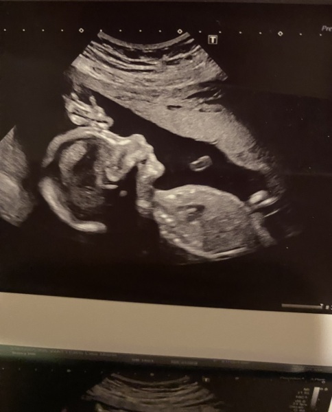Girl or boy